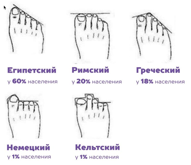 Tip stop.jpg Типы стопы.jpg